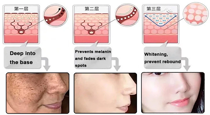 tetrahydrocurcumin Whitening tetrahydrocurcumin Whitening